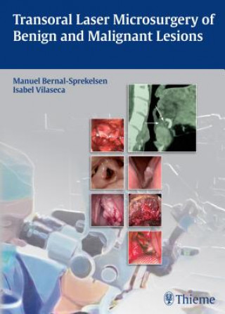 Kniha Transoral Laser Microsurgery of Benign and Malignant Lesions Manuel Bernal-Sprekelsen