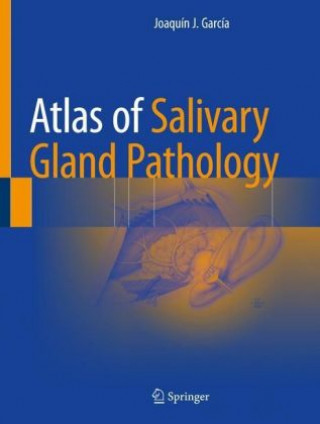 Kniha Atlas of Salivary Gland Pathology Joaquín J. García