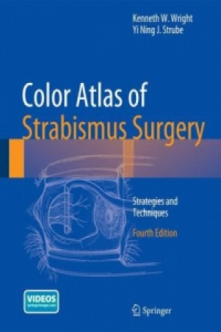 Knjiga Color Atlas Of Strabismus Surgery Kenneth W. Wright