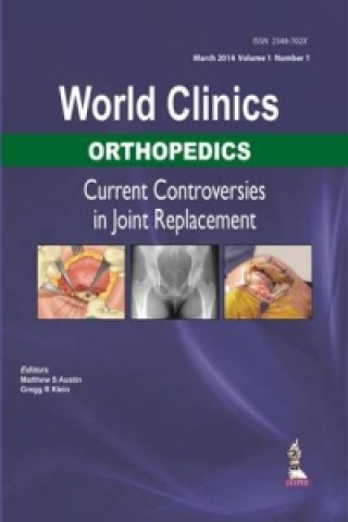 Libro World Clinics: Orthopedics: Current Controversies in Joint Replacement Matthew S Austin