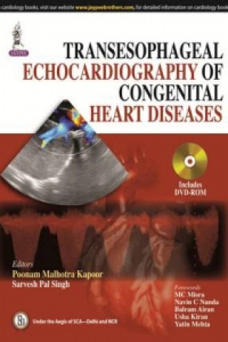 Könyv Transesophageal Echocardiography of Congenital Heart Diseases Poonam Malhotra Kapoor