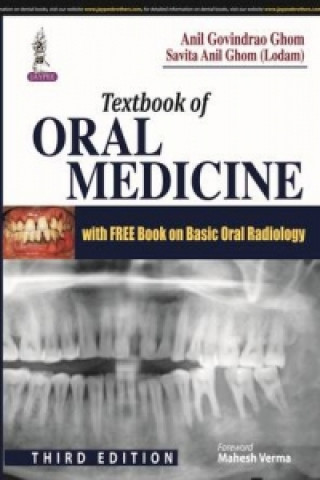 Carte Textbook of Oral Medicine Anil Govindrao Ghom