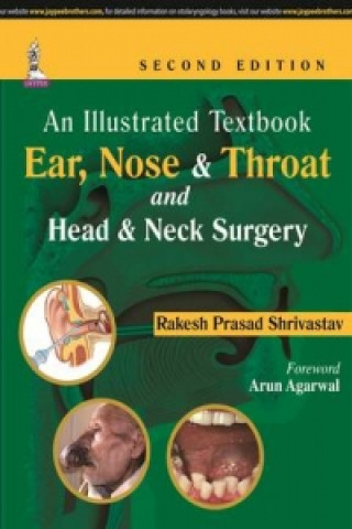 Kniha Illustrated Textbook: Ear, Nose & Throat and Head & Neck Surgery Rakesh Prasad Shrivastav
