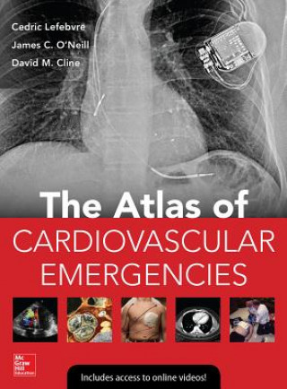 Książka Atlas of Cardiovascular Emergencies Cedric Lefebvre