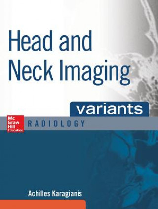 Książka Head and Neck Imaging Variants Achilles (NORTHWESTERN MEDICAL SCHL) Karagianis