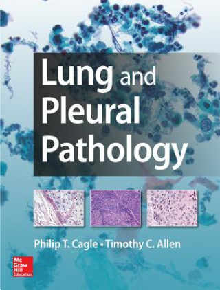 Kniha Lung and Pleural Pathology Philip T. Cagle