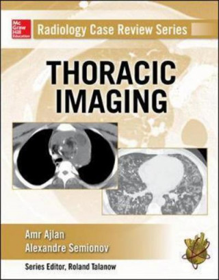 Kniha Radiology Case Review Series: Thoracic Imaging Amr M Ajlan