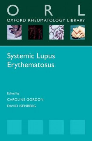 Kniha Systemic Lupus Erythematosus Caroline Gordon