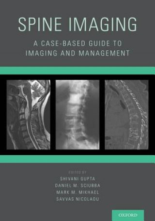 Książka Spine Imaging Shivani Gupta