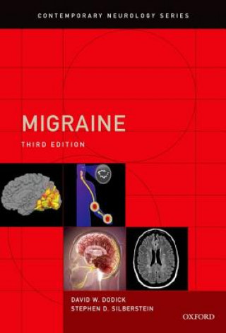 Książka Migraine David W. Dodick