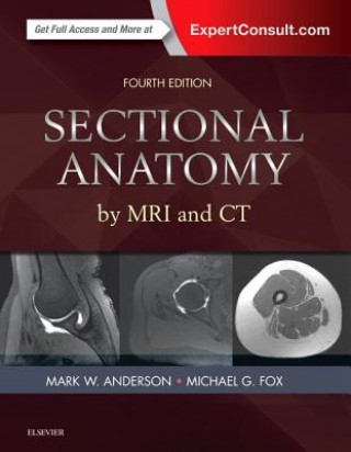 Könyv Sectional Anatomy by MRI and CT Mark W. Anderson