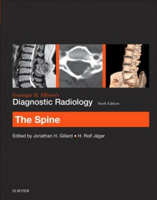 Carte Grainger & Allison's Diagnostic Radiology: The Spine Jonathan H. Gillard