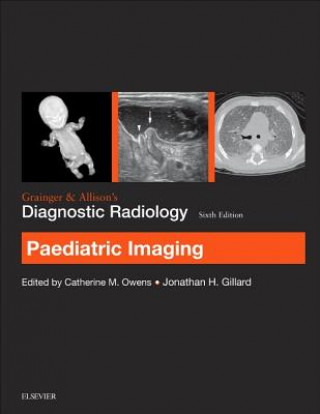 Carte Grainger & Allison's Diagnostic Radiology: Paediatric Imaging Catherine Owens