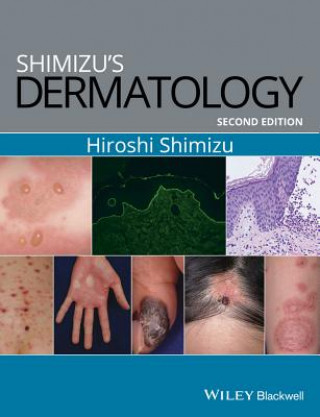 Könyv Shimizu's Dermatology, 2e Hiroshi Shimizu