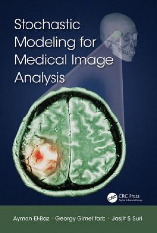 Carte Stochastic Modeling for Medical Image Analysis Ayman El-Baz
