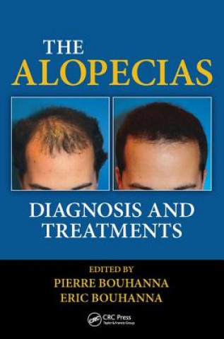 Könyv Alopecias Pierre Bouhanna