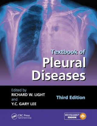 Buch Textbook of Pleural Diseases 