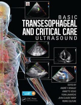 Könyv Basic Transesophageal and Critical Care Ultrasound 