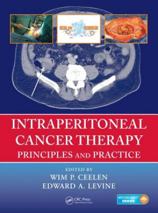 Kniha Intraperitoneal Cancer Therapy 