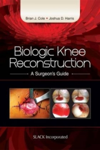 Libro Biologic Knee Reconstruction Brian J. Cole