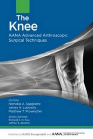 Knjiga Knee Nicholas A. Sgaglione