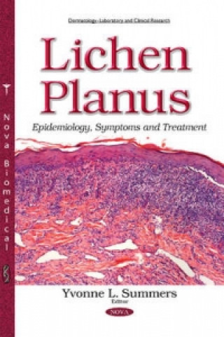 Kniha Lichen Planus 