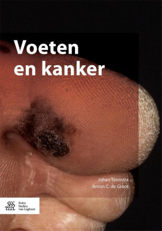 Книга Voeten en kanker Johan Toonstra