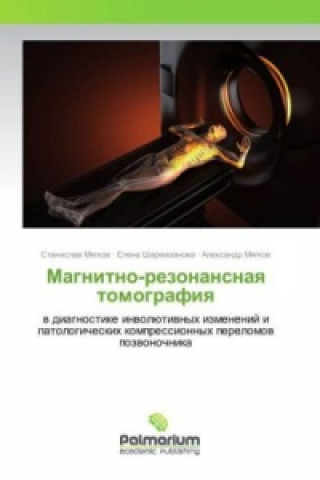 Könyv Magnitno-rezonansnaya tomografiya Stanislav Myagkov