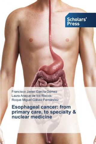 Buch Esophageal cancer Garcia Gomez Francisco Javier