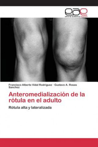 Könyv Anteromedializacion de la rotula en el adulto Vidal Rodriguez Francisco Alberto