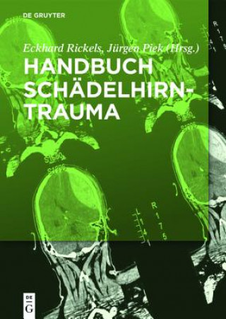 Carte Handbuch Schadelhirntrauma Eckhard Rickels