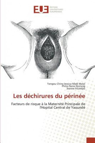 Buch Les Dechirures Du Perinee China-T