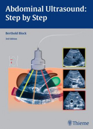 Knjiga Abdominal Ultrasound: Step by Step Berthold Block