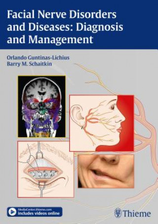 Kniha Facial Nerve Disorders and Diseases: Diagnosis and Management Orlando Guntinas-Lichius