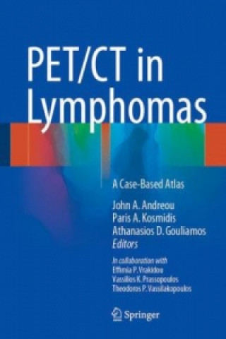 Kniha PET/CT in Lymphomas John A. Andreou