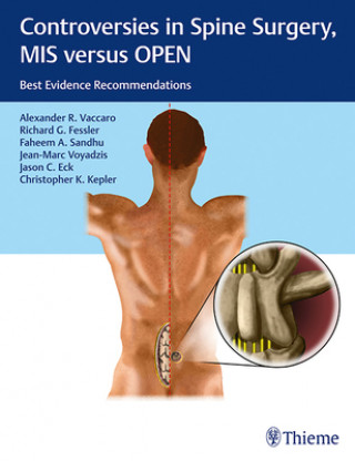 Książka Controversies in Spine Surgery, MIS versus OPEN Alexander R. Vaccaro