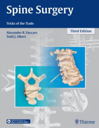 Carte Spine Surgery Todd J. Albert