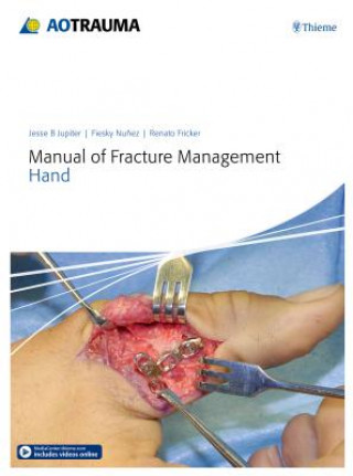 Knjiga Manual of Fracture Management - Hand Jesse B. Jupiter