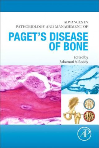 Könyv Advances in Pathobiology and Management of Paget's Disease of Bone Sakamuri V Reddy