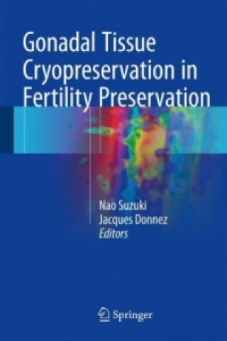 Livre Gonadal Tissue Cryopreservation in Fertility Preservation Nao Suzuki