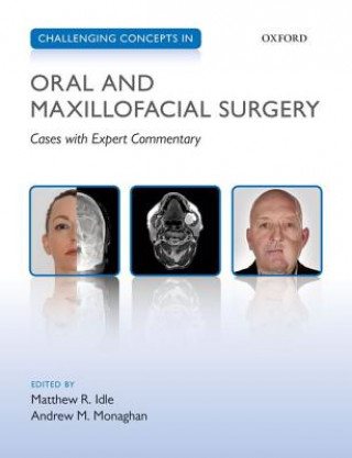 Carte Challenging Concepts in Oral and Maxillofacial Surgery Matthew Idle