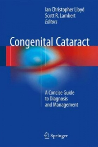 Buch Congenital Cataract Ian Christopher Lloyd