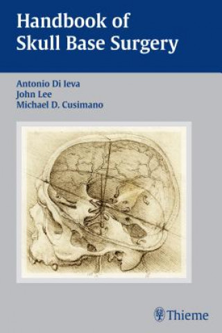 Kniha Handbook of Skull Base Surgery Antonio Di Ieva