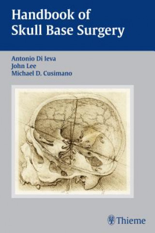 Carte Handbook of Skull Base Surgery Antonio Di Ieva