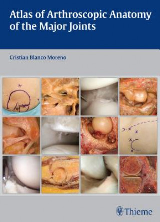 Carte Atlas of Arthroscopic Anatomy of the Major Joints Cristian Blanco Moreno