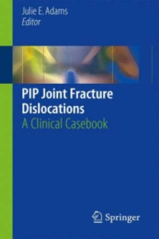 Carte PIP Joint Fracture Dislocations Julie E. Adams