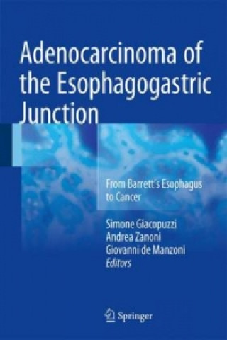 Kniha Adenocarcinoma of the Esophagogastric Junction Simone Giacopuzzi