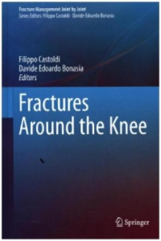 Kniha Fractures Around the Knee Filippo Castoldi