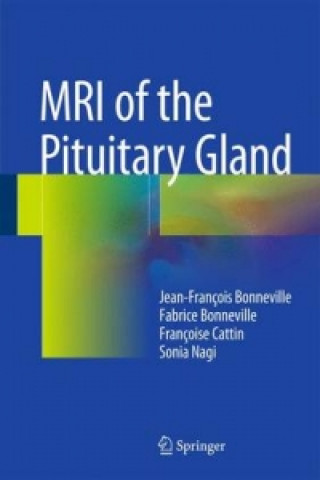 Kniha MRI of the Pituitary Gland Jean-François Bonneville