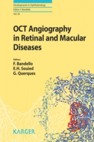 Kniha OCT Angiography in Retinal and Macular Diseases F. Bandello